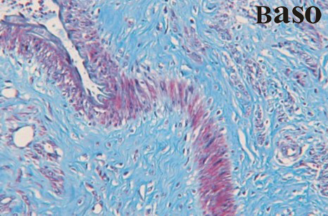 Masson��s Trichrome Stain
