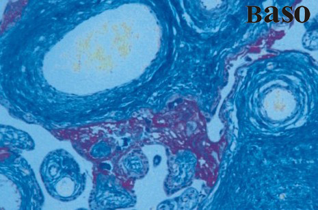 �R���S-����Ʒ�t-�����{(l��n)ȾɫҺ