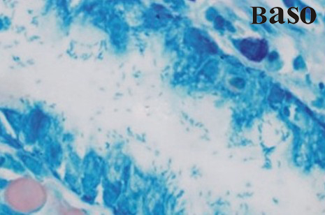 θ���T�ݗU��ȾɫҺ�����{(l��n)����